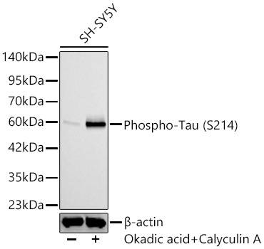 Western blot analysis lysates from SH-SY5Y, using Phospho-Tau (S214) Rabbit mAb at 1:1000 dilution. SH-SY5Y cells were treated with Okadaic Acid (100 nM) at 37℃ for 1 hour and Calyculin A (100nM) at 37℃ for 30 minutes after serum-starvation overnight.℃ for 30 minutes after serum-starvation overnight.|Secondary antibody: HRP-conjugated Goat anti-Rabbit IgG (H+L) at 1:10000 dilution.|Lysates/proteins: 25ug per lane.|Blocking buffer: 3% nonfat dry milk in TBST.|Detection: ECL Basic Kit.|Exposure time: 60s.