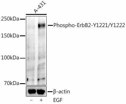 Western blot analysis of lysates from A-431 cells, using Phospho-ErbB2(Y1221 + Y1222) Rabbit mAb at 1:1000 dilution. A-431 cells were treated with EGF (200 ng/ml) at 37℃ for 30 minutes.|Secondary antibody: HRP-conjugated Goat anti-Rabbit IgG (H+L) at 1:10000 dilution.|Lysates/proteins: 25μg per lane.|Blocking buffer: 3% nonfat dry milk in TBST.|Detection: ECL Enhanced Kit.|Exposure time: 90s.