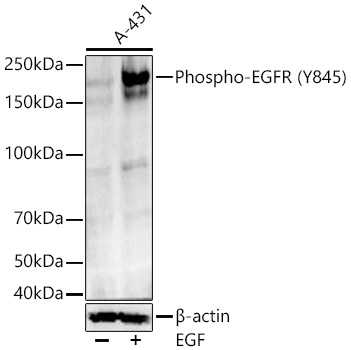 Western blot analysis of lysates from A-431 cells, using Phospho-EGFR-Y845 at 1:800 dilution. A-431 cells were treated with EGF (200 ng/ml) at 37℃ for 30 minutes.|Secondary antibody: HRP-conjugated Goat anti-Rabbit IgG (H+L) at 1:10000 dilution.|Lysates/proteins: 25μg per lane.|Blocking buffer: 3% nonfat dry milk in TBST.|Detection: ECL Basic Kit.|Exposure time: 180s.