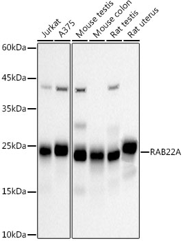 Western blot analysis of various lysates, using RAB22A Rabbit mAb at 1:1000 dilution.|Secondary antibody: HRP-conjugated Goat anti-Rabbit IgG (H+L) at 1:10000 dilution.|Lysates/proteins: 25μg per lane.|Blocking buffer: 3% nonfat dry milk in TBST.|Detection: ECL Basic Kit.|Exposure time: 30s.