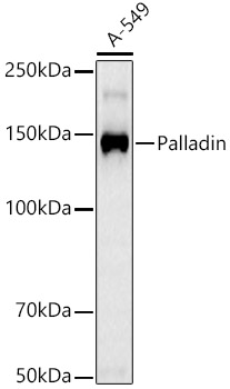 Western blot analysis of lysates from A-549 cells, using Palladin Rabbit mAb at 1:400 dilution.|Secondary antibody: HRP-conjugated Goat anti-Rabbit IgG (H+L) at 1:10000 dilution.|Lysates/proteins: 25μg per lane.|Blocking buffer: 3% nonfat dry milk in TBST.|Detection: ECL Basic Kit.|Exposure time: 90s.