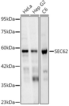 Western blot analysis of various lysates, using SEC62 Rabbit mAb at 1:1000 dilution.|Secondary antibody: HRP-conjugated Goat anti-Rabbit IgG (H+L) at 1:10000 dilution|Lysates/proteins: 25μg per lane.|Blocking buffer: 3% nonfat dry milk in TBST.|Detection: ECL Basic Kit.|Exposure time: 60s.