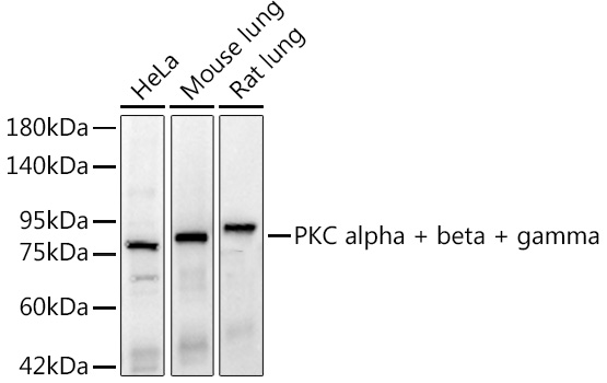 Western blot analysis of various lysates, using PKC alpha + beta + gamma Rabbit mAb at 1:2000 dilution.|Secondary antibody: HRP-conjugated Goat anti-Rabbit IgG (H+L) at 1:10000 dilution|Lysates/proteins: 25μg per lane.|Blocking buffer: 3% nonfat dry milk in TBST.|Detection: ECL Basic Kit.|Exposure time: 20s.