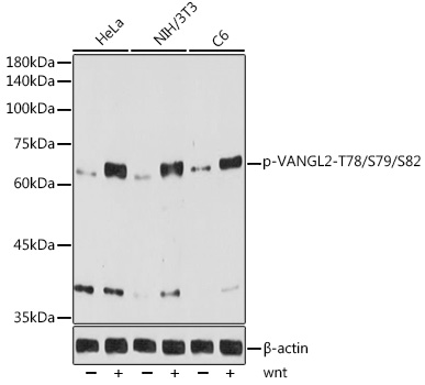 Western blot analysis of various lysates using Phospho-VANGL2-T78/S79/S82 Rabbit mAb at 1:1000 dilution. HeLa cells and NIH/3T3 cells and C6 cells were treated with wnt(100ng/ml) for 30 minutes.|Secondary antibody: HRP-conjugated Goat anti-Rabbit IgG (H+L) at 1:10000 dilution.|Lysates/proteins: 25μg per lane.|Blocking buffer: 3% nonfat dry milk in TBST.|Detection: ECL Basic Kit.|Exposure time: 60s.