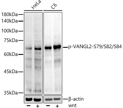 Western blot analysis of various lysates using Phospho-VANGL2-S79/S82/S84 Rabbit mAb at1:1000 dilution. HeLa and C6 cells were treated with wnt(100ng/ml) for 30 minutes.|Secondary antibody: HRP-conjugated Goat anti-Rabbit IgG (H+L) at1:10000 dilution.|Lysates/proteins: 25μg per lane.|Blocking buffer: 3% nonfat dry milk in TBST.|Detection: ECL Basic Kit.|Exposure time: 90s.