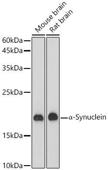 Western blot analysis of various lysates, using α-Synuclein Rabbit mAb at  1:1000 dilution.|Secondary antibody: HRP-conjugated Goat anti-Rabbit IgG (H+L) at 1:10000 dilution.|Lysates/proteins: 25μg per lane.|Blocking buffer: 3% nonfat dry milk in TBST.|Detection: ECL Basic Kit.|Exposure time: 30s.