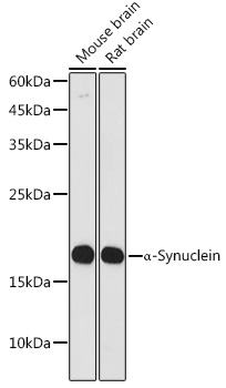 Western blot analysis of various lysates using α-Synuclein Rabbit mAb at1:1000 dilution.|Secondary antibody: HRP-conjugated Goat anti-Rabbit IgG (H+L) at1:10000 dilution.|Lysates/proteins: 25μg per lane.|Blocking buffer: 3% nonfat dry milk in TBST.|Detection: ECL Basic Kit.|Exposure time: 30s.