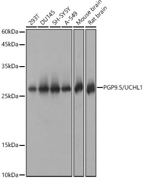 Western blot analysis of various lysates, using PGP9.5/UCHL1 Rabbit mAb at 1:1000 dilution.|Secondary antibody: HRP-conjugated Goat anti-Rabbit IgG (H+L) at 1:10000 dilution.|Lysates/proteins: 25μg per lane.|Blocking buffer: 3% nonfat dry milk in TBST.|Detection: ECL Basic Kit.|Exposure time: 1s.