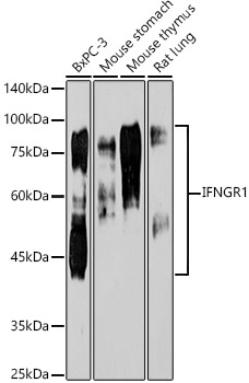 Western blot analysis of various lysates, using [KO Validated] IFNGR1 Rabbit mAb (A11653) at1:1000 dilution.|Secondary antibody: HRP-conjugated Goat anti-Rabbit IgG (H+L) (AS014) at 1:10000 dilution.|Lysates/proteins: 25μg per lane.|Blocking buffer: 3% nonfat dry milk in TBST.|Detection: ECL Enhanced Kit (RM00021).|Exposure time: 180s.