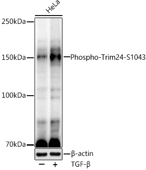 Western blot analysis of lysates from HeLa cells, using Phospho-Trim24-S1043 Rabbit mAb at1:1000 dilution. Hela cells were treated with TGF-β (10 ng/ml) at 37℃ for 30 minutes.|Secondary antibody: HRP-conjugated Goat anti-Rabbit IgG (H+L) at1:10000 dilution.|Lysates/proteins: 25μg per lane.|Blocking buffer: 3% nonfat dry milk in TBST.|Detection: ECL Enhanced Kit.|Exposure time: 180s.