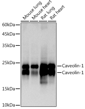 Western blot analysis of various lysates using Caveolin-1  Rabbit mAb at 1:1000 dilution.|Secondary antibody: HRP-conjugated Goat anti-Rabbit IgG (H+L) at 1:10000 dilution.|Lysates/proteins: 25μg per lane.|Blocking buffer: 3% nonfat dry milk in TBST.|Detection: ECL Basic Kit.|Exposure time: 3s.