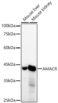 Western blot analysis of various lysates, using AMACR Rabbit mAb at 1:1000 dilution.|Secondary antibody: HRP-conjugated Goat anti-Rabbit IgG (H+L) at 1:10000 dilution.|Lysates/proteins: 25μg per lane.|Blocking buffer: 3% nonfat dry milk in TBST.|Detection: ECL Basic Kit.|Exposure time: 30s.