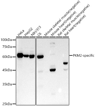 Western blot analysis of various lysates, using PKM2-specific Rabbit mAb at 1:1000 dilution.|Secondary antibody: HRP-conjugated Goat anti-Rabbit IgG (H+L) at 1:10000 dilution.|Lysates/proteins: 25μg per lane.|Blocking buffer: 3% nonfat dry milk in TBST.|Detection: ECL Basic Kit.|Exposure time: 30s.