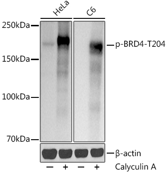 Western blot analysis of various lysates using  at1:1000 dilution. HeLa cells were treated with Calyculin A (100 nM) at 37℃ for 30 minutes after serum-starvation overnight. C6 cells were treated with Calyculin A (100 nM) at 37℃ for 30 minutes after serum-starvation overnight.|Secondary antibody: HRP-conjugated Goat anti-Rabbit IgG (H+L) at1:10000 dilution.|Lysates/proteins: 25μg per lane.|Blocking buffer: 3% nonfat dry milk in TBST.|Detection: ECL Basic Kit.|Exposure time: 1s.