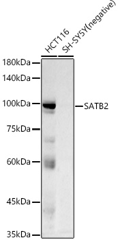 Western blot analysis of various lysates using SATB2 Rabbit mAb at1:10000 dilution.|Secondary antibody: HRP-conjugated Goat anti-Rabbit IgG (H+L) at 1:10000 dilution.|Lysates/proteins: 25μg per lane.|Blocking buffer: 3% nonfat dry milk in TBST.|Detection: ECL Basic Kit.|Exposure time: 90s.