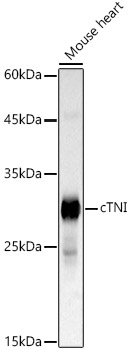 Western blot analysis of lysates from Mouse heart, using cTNI Rabbit mAb at 1:20000 dilution.|Secondary antibody: HRP-conjugated Goat anti-Rabbit IgG (H+L) at 1:10000 dilution.|Lysates/proteins: 25μg per lane.|Blocking buffer: 3% nonfat dry milk in TBST.|Detection: ECL Basic Kit.|Exposure time: 1s.