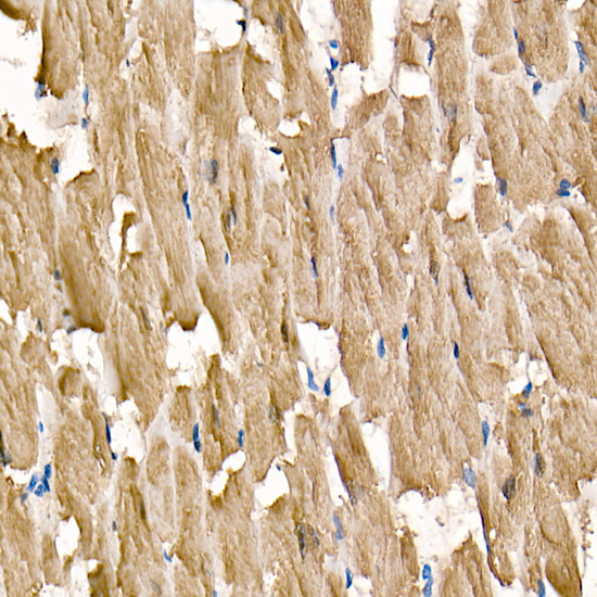 Immunohistochemistry analysis of paraffin-embedded Human heart using Cardiac Troponin I (TNNI3) Rabbit mAb at dilution of 1:100 (40x lens). High pressure antigen retrieval performed with 0.01M Citrate buffer (pH 6.0) prior to IHC staining.