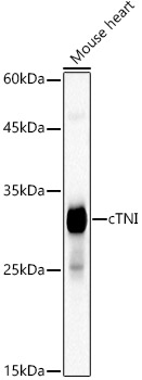 Western blot analysis of lysates from Mouse heart, using Cardiac Troponin I (TNNI3) Rabbit mAb at1:3000 dilution.|Secondary antibody: HRP-conjugated Goat anti-Rabbit IgG (H+L) at 1:10000 dilution.|Lysates/proteins: 25μg per lane.|Blocking buffer: 3% nonfat dry milk in TBST.|Detection: ECL Basic Kit.|Exposure time: 10s.