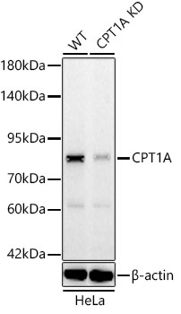 Western blot analysis of lysates from wild type (WT) and CPT1A knockdown (KD) HeLa cells using [KD Validated] CPT1A Rabbit mAb (A22450) at 1:1000 dilution incubated overnight at 4℃.|Secondary antibody: HRP-conjugated Goat anti-Rabbit IgG (H+L) (AS014) at 1:10000 dilution.|Lysates/proteins: 25 μg per lane.|Blocking buffer: 3% nonfat dry milk in TBST.|Detection: ECL Basic Kit (RM00020).|Exposure time: 45s.