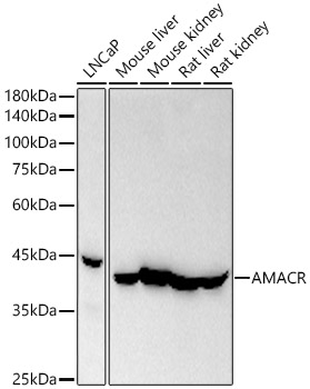Western blot analysis of various lysates, using AMACR Rabbit mAb at  1:2000 dilution.|Secondary antibody: HRP-conjugated Goat anti-Rabbit IgG (H+L) at 1:10000 dilution.|Lysates/proteins: 25μg per lane.|Blocking buffer: 3% nonfat dry milk in TBST.|Detection: ECL Basic Kit.|Exposure time: 10s.