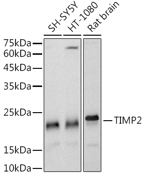 Western blot analysis of various lysates using TIMP2 Rabbit mAb at1:1000 dilution.|Secondary antibody: HRP-conjugated Goat anti-Rabbit IgG (H+L) at1:10000 dilution.|Lysates/proteins: 25μg per lane.|Blocking buffer: 3% nonfat dry milk in TBST.|Detection: ECL Basic Kit.|Exposure time: 20s.