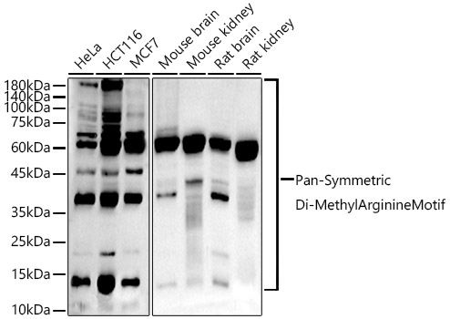 Western blot analysis of various lysates using Pan-Symmetric Di-Methyl Arginine Motif Rabbit mAb at  1:1000 dilution.|Secondary antibody: HRP-conjugated Goat anti-Rabbit IgG (H+L) at 1:10000 dilution.|Lysates/proteins: 25 μg per lane.|Blocking buffer: 3% nonfat dry milk in TBST.|Detection: ECL Basic Kit.|Exposure time: 180 s.