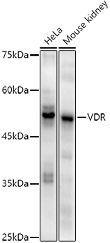 Western blot analysis of various lysates using VDR Rabbit mAb at1:1000 dilution.|Secondary antibody: HRP-conjugated Goat anti-Rabbit IgG (H+L) at1:10000 dilution.|Lysates/proteins: 25μg per lane.|Blocking buffer: 3% nonfat dry milk in TBST.|Detection: ECL Enhanced Kit.|Exposure time: 90s.