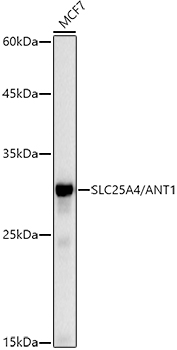 Western blot analysis of lysates from MCF7 cells, using [KO Validated] SLC25A4/ANT1 Rabbit mAb at1:1000 dilution.|Secondary antibody: HRP-conjugated Goat anti-Rabbit IgG (H+L) at1:10000 dilution.|Lysates/proteins: 25μg per lane.|Blocking buffer: 3% nonfat dry milk in TBST.|Detection: ECL Basic Kit.|Exposure time: 10s.
