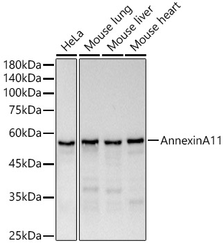 Western blot analysis of various lysates, using Annexin A11  Rabbit mAb at  1:1000 dilution.|Secondary antibody: HRP-conjugated Goat anti-Rabbit IgG (H+L) at 1:10000 dilution.|Lysates/proteins: 25μg per lane.|Blocking buffer: 3% nonfat dry milk in TBST.|Detection: ECL Basic Kit.|Exposure time: 20s.