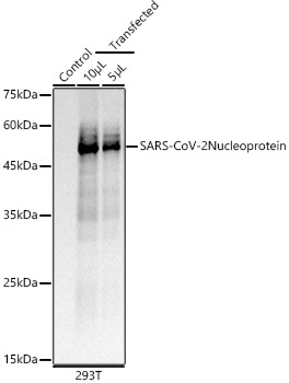 Western blot analysis of lysates from 293T cells, using SARS-CoV-2 Nucleoprotein Rabbit mAb at  1:10000 dilution.|Secondary antibody: HRP-conjugated Goat anti-Rabbit IgG (H+L) at 1:10000 dilution.|Lysates/proteins: 25μg per lane.|Blocking buffer: 3% nonfat dry milk in TBST.|Detection: ECL Basic Kit.|Exposure time: 0.2s.