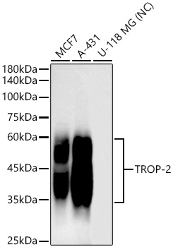 Western blot analysis of various lysates using TROP-2 Rabbit mAb at1:1000 dilution.|Secondary antibody: HRP-conjugated Goat anti-Rabbit IgG (H+L) at1:10000 dilution.|Lysates/proteins: 25μg per lane.|Blocking buffer: 3% nonfat dry milk in TBST.|Detection: ECL Basic Kit.|Exposure time: 60s.