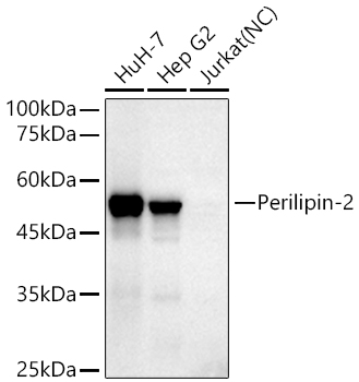 Western blot analysis of various lysates using Perilipin-2 Rabbit mAb at 1:1000 dilution incubated overnight at 4℃.|Secondary antibody: HRP-conjugated Goat anti-Rabbit IgG (H+L) at 1:10000 dilution.|Lysates/proteins: 25 μg per lane.|Blocking buffer: 3% nonfat dry milk in TBST.|Detection: ECL Basic Kit.|Negative control (NC): Jurkat|Exposure time: 10s.