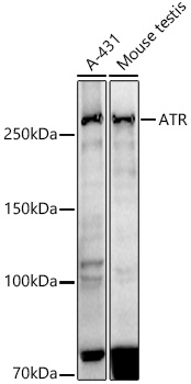 Western blot analysis of various lysates using ATR Rabbit mAb at1:1000 dilution.|Secondary antibody: HRP-conjugated Goat anti-Rabbit IgG (H+L) at 1:10000 dilution.|Lysates/proteins: 25μg per lane.|Blocking buffer: 3% nonfat dry milk in TBST.|Detection: ECL Basic Kit.|Exposure time: 180s.