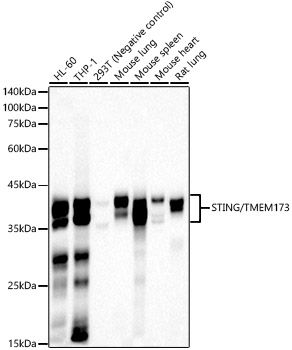 Western blot analysis of various lysates, using STING/TMEM173 Rabbit mAb at 1:1000 dilution.|Secondary antibody: HRP-conjugated Goat anti-Rabbit IgG (H+L) at 1:10000 dilution.|Lysates/proteins: 25μg per lane.|Blocking buffer: 3% nonfat dry milk in TBST.|Detection: ECL Basic Kit.|Exposure time: 90s.