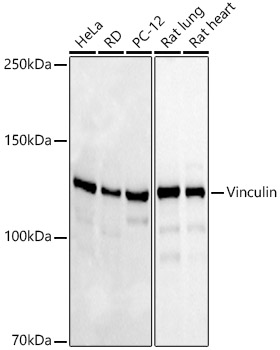 Western blot analysis of various lysates, using Vinculin Rabbit mAb at 1:1000 dilution.|Secondary antibody: HRP-conjugated Goat anti-Rabbit IgG (H+L) at 1:10000 dilution.|Lysates/proteins: 25μg per lane.|Blocking buffer: 3% nonfat dry milk in TBST.|Detection: ECL Basic Kit.|Exposure time: 15s.