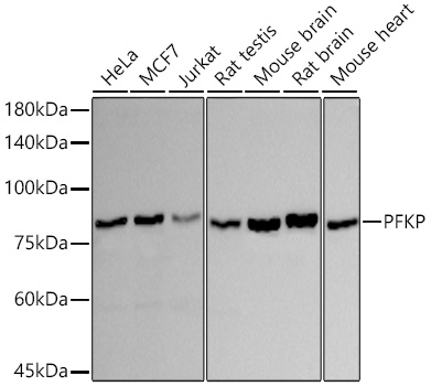 Western blot analysis of various lysates using PFKP Rabbit mAb at 1:1000 dilution incubated overnight at 4℃.|Secondary antibody: HRP-conjugated Goat anti-Rabbit IgG (H+L) at 1:10000 dilution.|Lysates/proteins: 25 μg per lane.|Blocking buffer: 3% nonfat dry milk in TBST.|Detection: ECL Basic Kit.|Exposure time: 30s.