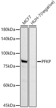 Western blot analysis of various lysates, using PFKP Rabbit mAb at  1:1000 dilution.|Secondary antibody: HRP-conjugated Goat anti-Rabbit IgG (H+L) at 1:10000 dilution.|Lysates/proteins: 25μg per lane.|Blocking buffer: 3% nonfat dry milk in TBST.|Detection: ECL Basic Kit.|Exposure time: 15s.