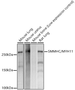 Western blot analysis of various lysates, using SMMHC/MYH11 Rabbit mAb at 1:1000 dilution.|Secondary antibody: HRP-conjugated Goat anti-Rabbit IgG (H+L) at 1:10000 dilution.|Lysates/proteins: 25μg per lane.|Blocking buffer: 3% nonfat dry milk in TBST.|Detection: ECL Basic Kit.|Exposure time: 10s.
