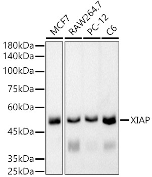Western blot analysis of various lysates using [KO Validated] XIAP Rabbit mAb (A22345) at 1:5000 dilution.|Secondary antibody: HRP-conjugated Goat anti-Rabbit IgG (H+L) (AS014) at 1:10000 dilution.|Lysates/proteins: 25μg per lane.|Blocking buffer: 3% nonfat dry milk in TBST.|Detection: ECL Basic Kit (RM00020).|Exposure time: 90s.