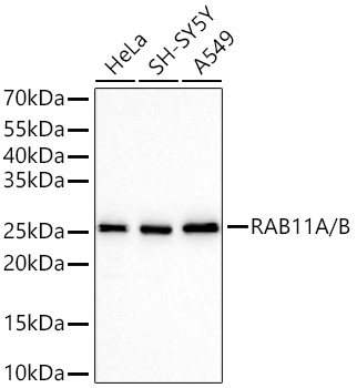 Western blot analysis of various lysates using RAB11A/B Rabbit mAb at 1:40000 dilution incubated overnight at 4℃.|Secondary antibody: HRP-conjugated Goat anti-Rabbit IgG (H+L) at 1:10000 dilution.|Lysates/proteins: 25 μg per lane.|Blocking buffer: 3% nonfat dry milk in TBST.|Detection: ECL Basic Kit.|Exposure time: 30s.