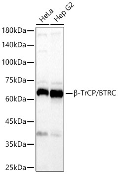 Western blot analysis of various lysates using β-TrCP/BTRC Rabbit mAb (A21951) at 1:2000 dilution incubated overnight at 4℃.|Secondary antibody: HRP-conjugated Goat anti-Rabbit IgG (H+L) (AS014) at 1:10000 dilution.|Lysates/proteins: 25 μg per lane.|Blocking buffer: 3% nonfat dry milk in TBST.|Detection: ECL Basic Kit (RM00020).|Exposure time: 1s.