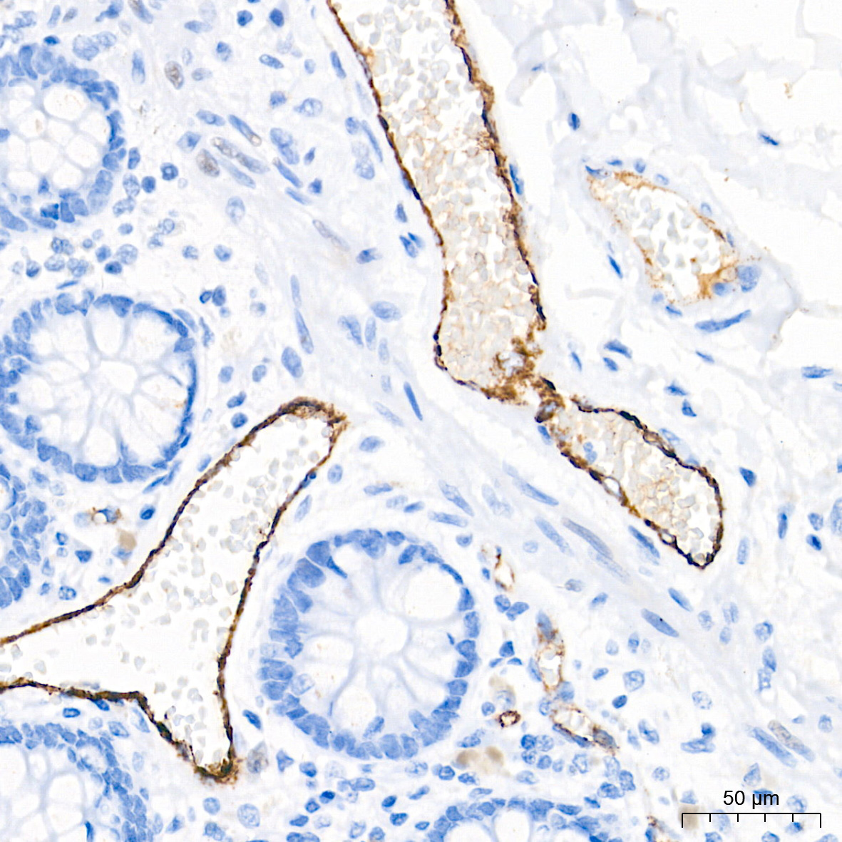 Immunohistochemistry analysis of paraffin-embedded Human colon tissue using von Willebrand factor (VWF) Rabbit mAb (A21054) at a dilution of 1:600 (40x lens). High pressure antigen retrieval performed with 0.01M Tris-EDTA Buffer (pH 9.0) prior to IHC staining.
