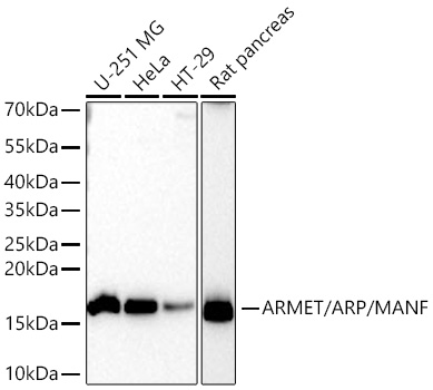 Western blot analysis of various lysates using ARMET/ARP/MANF Rabbit mAb at 1:20000 dilution incubated at room temperature for 1.5 hours.|Secondary antibody: HRP-conjugated Goat anti-Rabbit IgG (H+L) at 1:10000 dilution.|Lysates/proteins: 25 μg per lane.|Blocking buffer: 3% nonfat dry milk in TBST.|Detection: ECL Basic Kit.|Exposure time: 60 s.