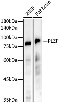 Western blot analysis of various lysates using PLZF Rabbit mAb at  1:10000 dilution.|Secondary antibody: HRP-conjugated Goat anti-Rabbit IgG (H+L) at 1:10000 dilution.|Lysates/proteins: 25μg per lane.|Blocking buffer: 3% nonfat dry milk in TBST.|Detection: ECL Basic Kit.|Exposure time: 90s.