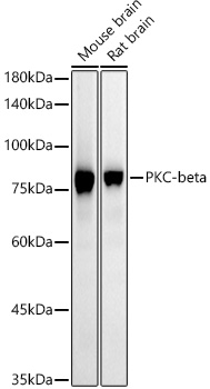 Western blot analysis of various lysates using PKC-beta Rabbit mAb at1:4000 dilution.|Secondary antibody: HRP-conjugated Goat anti-Rabbit IgG (H+L) at 1:10000 dilution.|Lysates/proteins: 25μg per lane.|Blocking buffer: 3% nonfat dry milk in TBST.|Detection: ECL Basic Kit.|Exposure time: 30s.