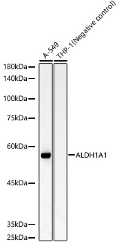 Western blot analysis of various lysates, using ALDH1A1 Rabbit mAb at 1:10000 dilution.|Secondary antibody: HRP-conjugated Goat anti-Rabbit IgG (H+L) at 1:10000 dilution.|Lysates/proteins: 25μg per lane.|Blocking buffer: 3% nonfat dry milk in TBST.|Detection: ECL Basic Kit.|Exposure time: 30s.