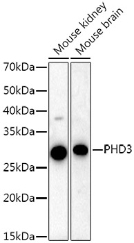 Western blot analysis of various lysates using PHD3 Rabbit mAb at  1:20000 dilution.|Secondary antibody: HRP-conjugated Goat anti-Rabbit IgG (H+L) at 1:10000 dilution.|Lysates/proteins: 25μg per lane.|Blocking buffer: 3% nonfat dry milk in TBST.|Detection: ECL Basic Kit.|Exposure time: 60s.