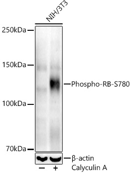 Western blot analysis of lysates from NIH/3T3 cells, using Phospho-RB-S780 Rabbit mAb at 1:10000 dilution. NIH/3T3 cells were treated with Calyculin A (100 nM) at 37℃ for 30 minutes after serum-starvation overnight.|Secondary antibody: HRP-conjugated Goat anti-Rabbit IgG (H+L) at 1:10000 dilution.|Lysates/proteins: 25μg per lane.|Blocking buffer: 3% nonfat dry milk in TBST.|Detection: ECL Enhanced Kit.|Exposure time: 90s.