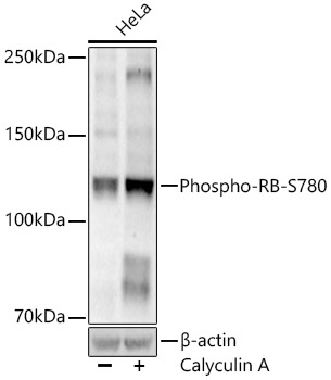 Western blot analysis of lysates from HeLa cells, using Phospho-RB-S780 Rabbit mAb at 1:19000 dilution. HeLa cells were treated with Calyculin A (100 nM) at 37℃ for 30 minutes after serum-starvation overnight.|Secondary antibody: HRP-conjugated Goat anti-Rabbit IgG (H+L) at 1:10000 dilution.|Lysates/proteins: 25μg per lane.|Blocking buffer: 3% nonfat dry milk in TBST.|Detection: ECL Enhanced Kit.|Exposure time: 60s.
