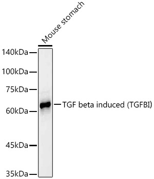 Western blot analysis of lysates from Mouse stomach, using TGF beta induced (TGFBI)Rabbit mAb (A23275) at 1:2000 dilution.|Secondary antibody: HRP-conjugated Goat anti-Rabbit IgG (H+L) (AS014) at 1:10000 dilution.|Lysates/proteins: 25μg per lane.|Blocking buffer: 3% nonfat dry milk in TBST.|Detection: ECL Basic Kit (RM00020).|Exposure time: 30s.